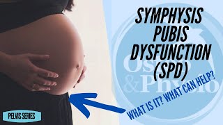 SYMPHYSIS PUBIS DYSFUNCTION (SPD)