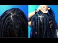 Will Dreads Make You Go Bald? | Causes of LONG Thinning Dreads & Balding