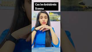 Hand Eczema #eczema #allergy #itching #skinspecialist #dermatologist #skincare #skindisease #skin