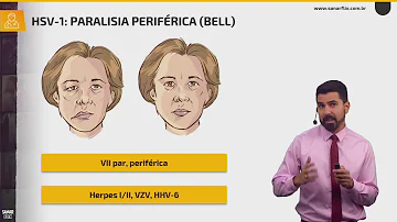 O que o vírus da herpes pode causar?