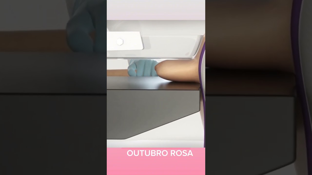 Mamografia: Tudo o que Você Precisa Saber em Segundos!#radiologiamedica #radiologiaveterinaria