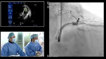 [TCTAP 2019] Coronary Symposium - Live Case & Lecture Session II