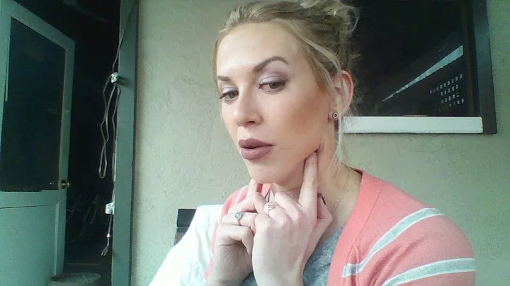 Kybella 6 Week Update