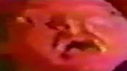 Polkas On 45 (Pre-Album Version) but every word skips to it