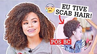 Scab hair: o que é e como tratar o problema - Prohall Professional