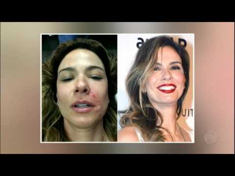 Vídeo: Tratamento Facial Favorito Das Atrizes