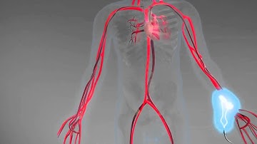 Whole Body Bio-Impedance
