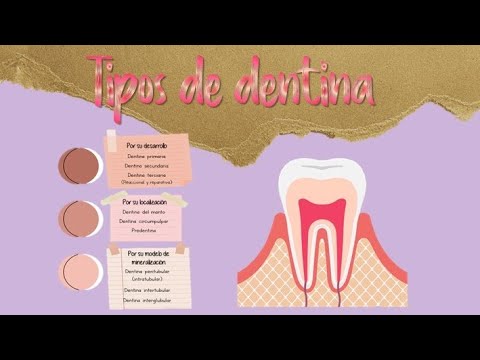 Video: ¿Dónde es más común la esquizofrenia?