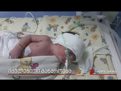 იძულებითი განშორება