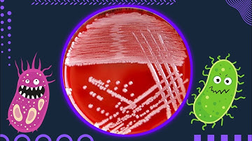 Blood Agar and Hemolysis: Alpha, Beta & Gamma with Bacterial Examples