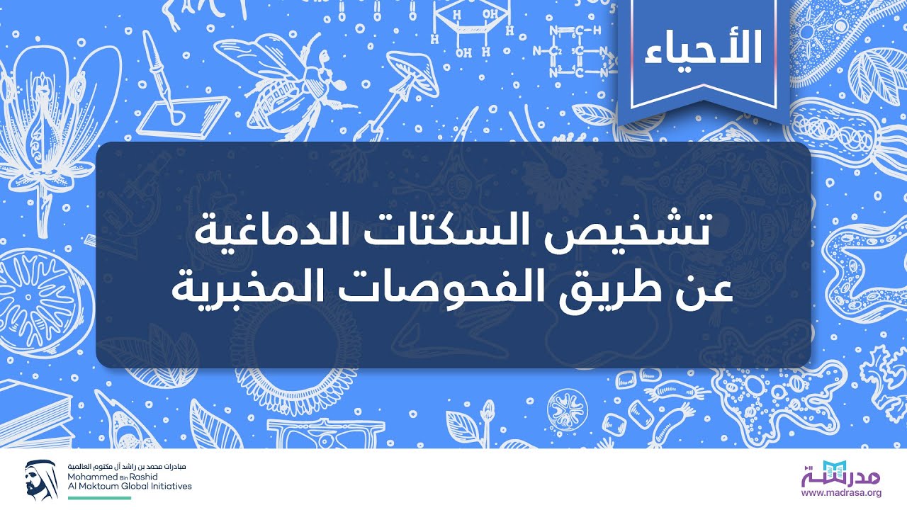 تشخيص السكتات الدماغية عن طريق الفحوصات المخبرية |الأحياء | أمراض الجهاز الدوري