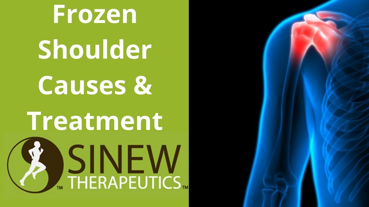 Frozen Shoulder Causes and Treatment YouTube