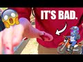 KTM Ride Day SPOILED! Almost LOST His FINGER! Electric Dirtbikes?