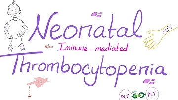 Neonatal Immune-Mediated Thrombocytopenia