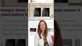 Let's Talk About Artificial Intelligence and Breast Cancer Detection