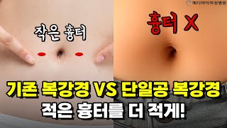 단일공 복강경 수술이란 어떤 수술인가요? (#복강경수술 #단공법 #다공법)