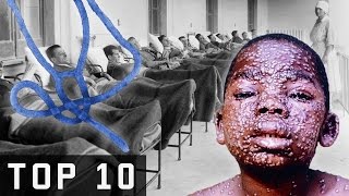 Top 10 Most Deadliest Diseases In Modern Human History