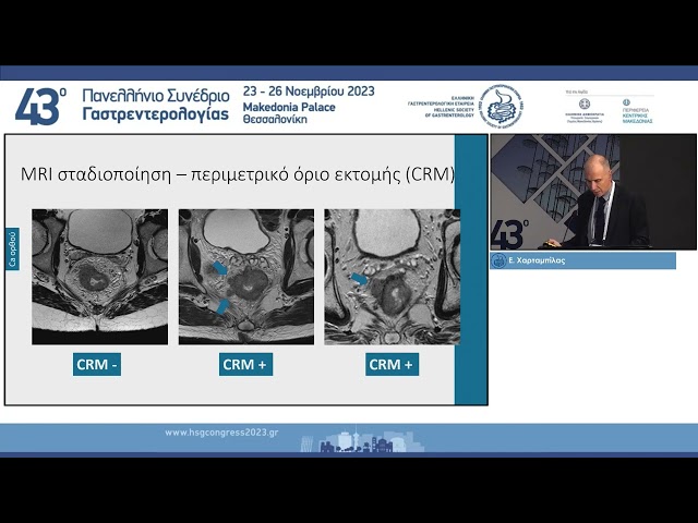 Day 2-A2-1600_1700 03 Ε  Χαρταμπίλας