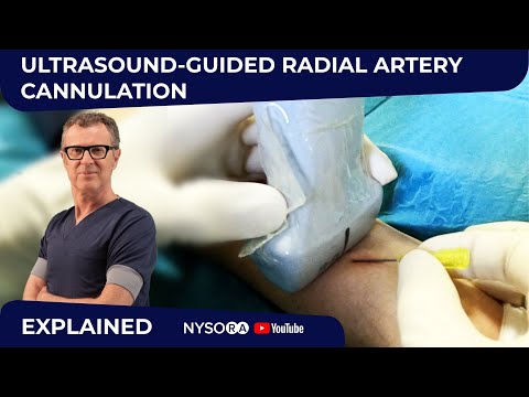 Ultrasound-Guided Radial Artery Cannulation - Crash course with Dr. Hadzic