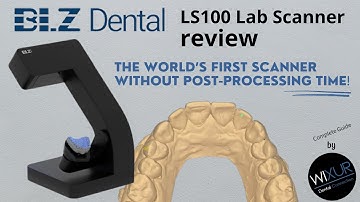 Dental Lab Scanner Review: A Must in Digital Dentistry!