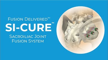 SI-Cure Sacroiliac Joint Fusion System