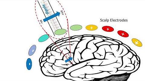 EEG - Electrical 