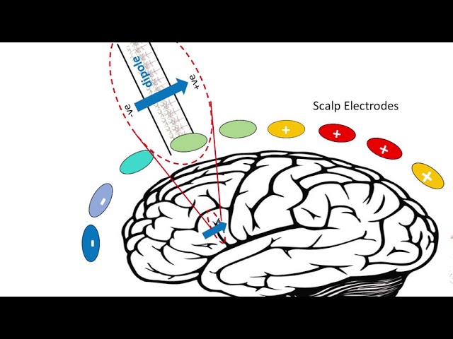 EEG - Electrical 'Brainwaves' class=