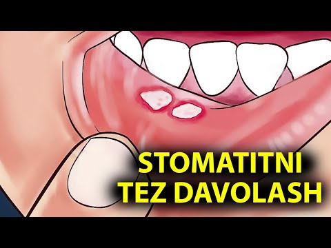 Video: Davolash kontrastlari nima?