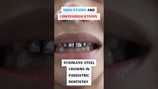 Stainless steel crowns in paediatric patients. #stainlesssteel #paediatricdentistry #dentist #crown