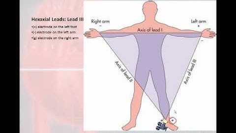 12 Lead Interpretation Part 1: Introduction to the 12 Lead EKG