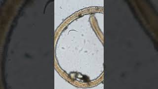 Worm AMBUSHES microbe under the microscope #microscope #science