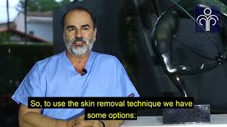 Flacidez Nos Seios. Como Tratar?