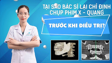 NKHC - Tại Sao Bác Sĩ Lại Chỉ Định Chụp Phim X - Quang Thì Mới Chẩn Đoán Trước Khi Điều Trị?