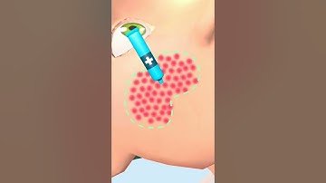 ✅ Parasite Cleaner 🐛🦠🐞 Max Levels Gameplay iOS Android Walkthrough Update Level