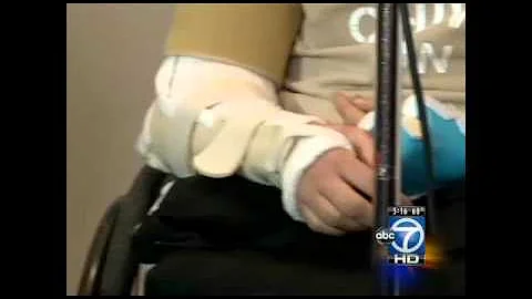 Ryan Emmons has arm reattached after Beltway accid...