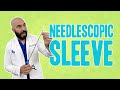 Needlescopic Sleeve | Gastric Sleeve Surgery | Questions and Answers