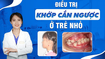 Điều Trị Khớp Cắn Ngược Ở Trẻ Nhỏ | Nam Bùi Vinalign