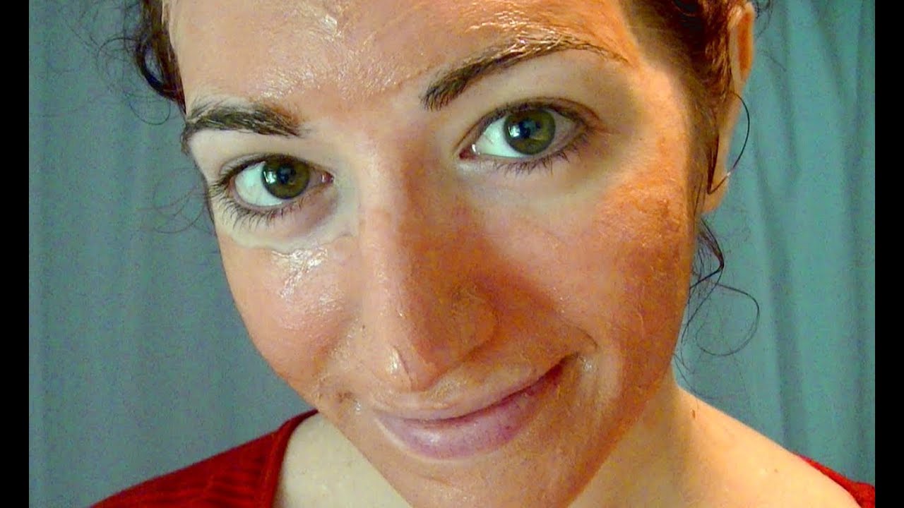 Clear Acne Naturally! Cure & Remove Spots, Pimples, Zits & Scars for Healthy Skin!