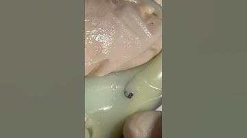 Mochi Pimple Popping #pimplepopping #satisfying #visualasmr #relax #cats #oddlysatisfying