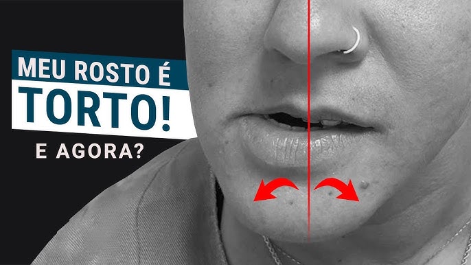 Barulhos no ouvido? Pode ser a Articulação temporomandibular – Dr