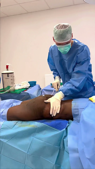 Buttock lift #Nordesthetics #Nordestheticsclinic #medicaltourism #plasticsurgery #shorts #bbl