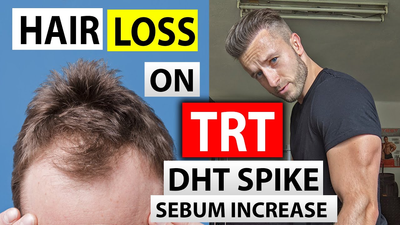 DHT Dihydrotestosterone Role in Hair Loss How to Reduce It  Dr Axe