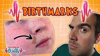 Operation Ouch  Brilliant Birthmarks | Human Skin