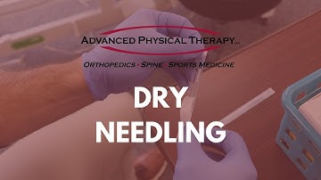 What is Dry Needling?