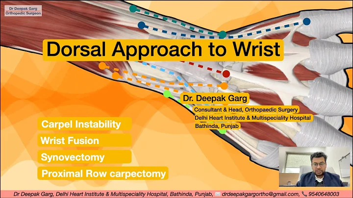 Mastering the Dorsal Approach to Wrist Surgery:  Approach to Distal Radius & Wrist Fusion Technique