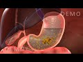 THE HUMAN DIGESTIVE SYSTEM OESOPHAGUS AND STOMACH v02