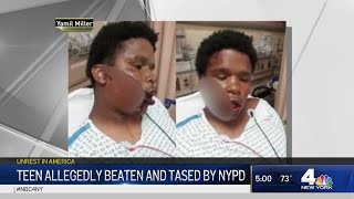 Teen Allegedly Beaten and Tased By NYPD