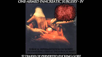 One Armed Pancreatic Surgery - The Mutilated Body Of Ryan Seacrest Feat. Moe Lest(h)er