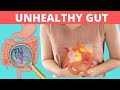 7 Signs of An Unhealthy Gut And 7 Ways To Improve Gut Health.