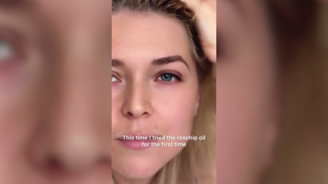 Glowing Skin with Rosehip Oil | Kanzy Collab with Sofia 